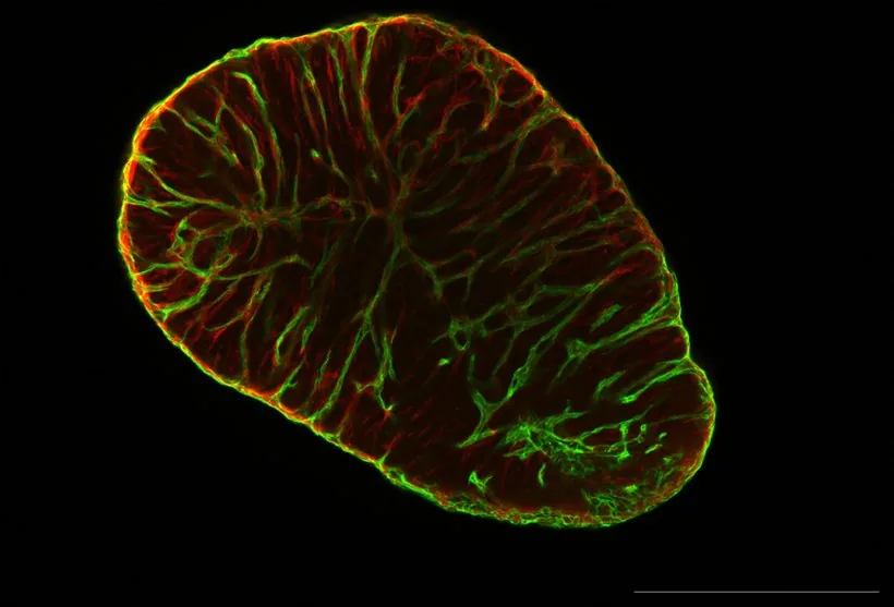 Confocal immunofluorescence of the self-assembled vascular network with CD31 endothelium in green and PDGFRB pericytes in red